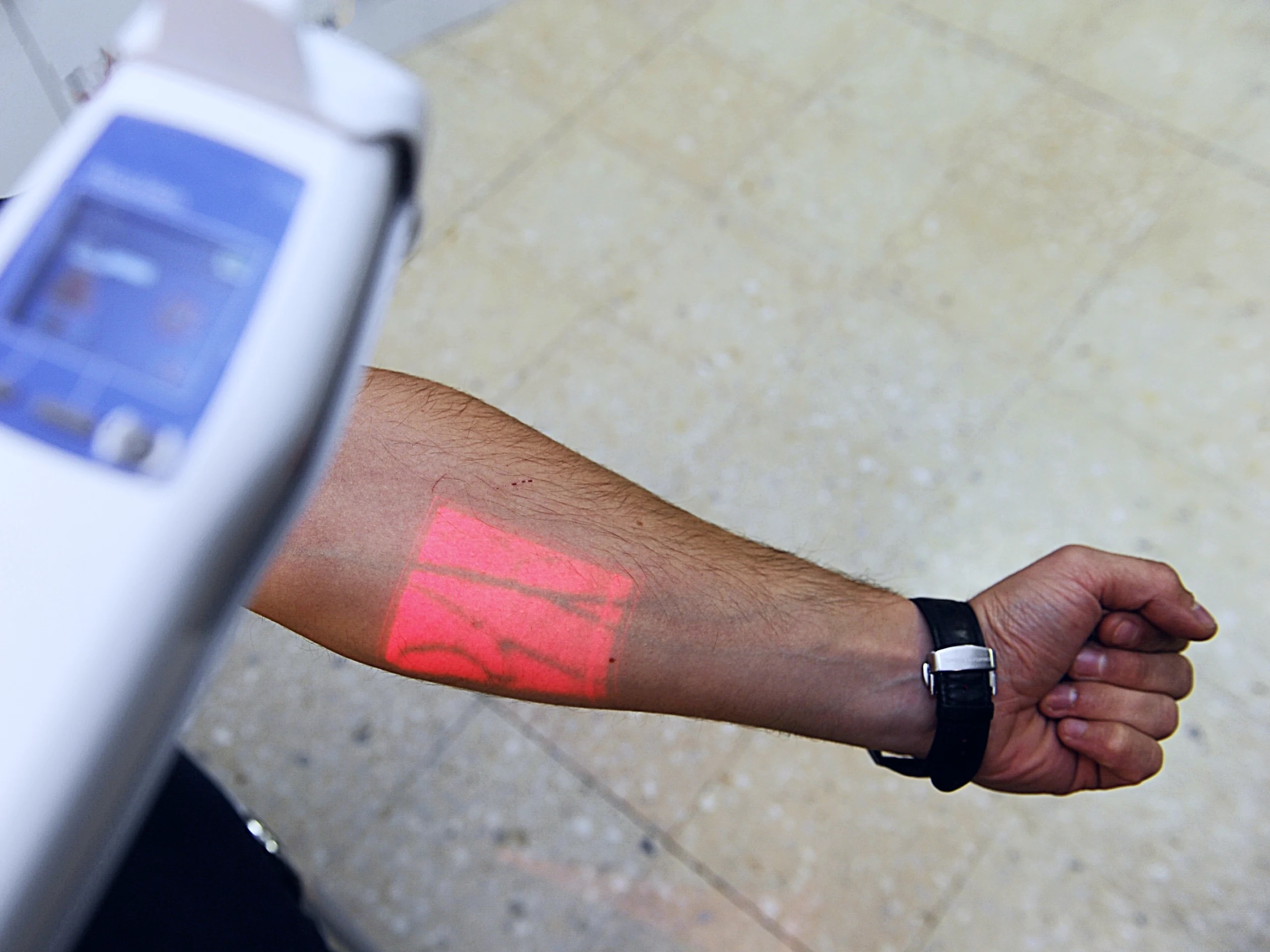 Vein Finder Devices